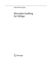 Microskin Grafting for Vitiligo Cover Image