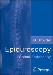 Epiduroscopy — Spinal Endoscopy Cover Image