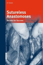 Sutureless Anastomoses Secrets for Success  Cover Image
